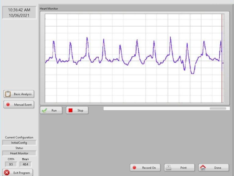 cardiac-waveform-screen